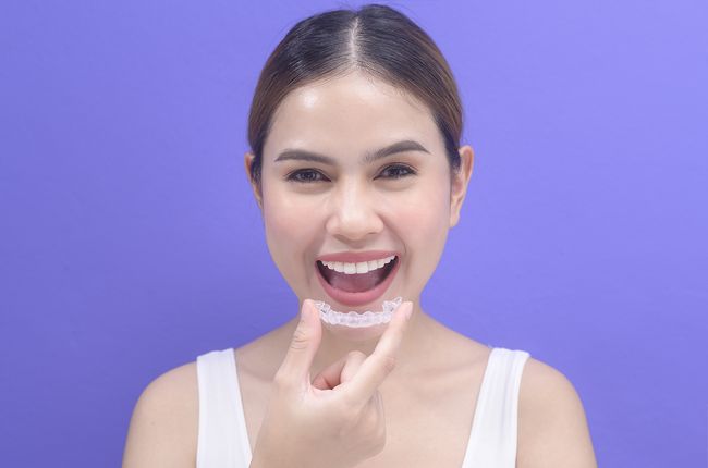 Invisalign service image